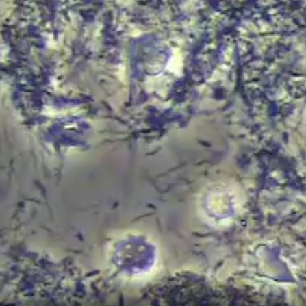 歯周病医療病態研究-パーフェクトペリオ®【公式】-05-19-2025_02_56_PM