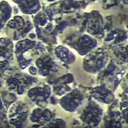 歯周病医療病態研究-パーフェクトペリオ®【公式】-05-19-2025_02_59_PM